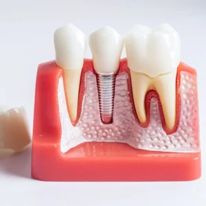 safe dental treatment in tirupati