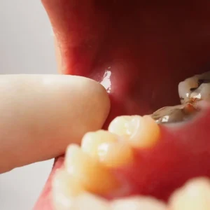 affordable root canal treatment near me