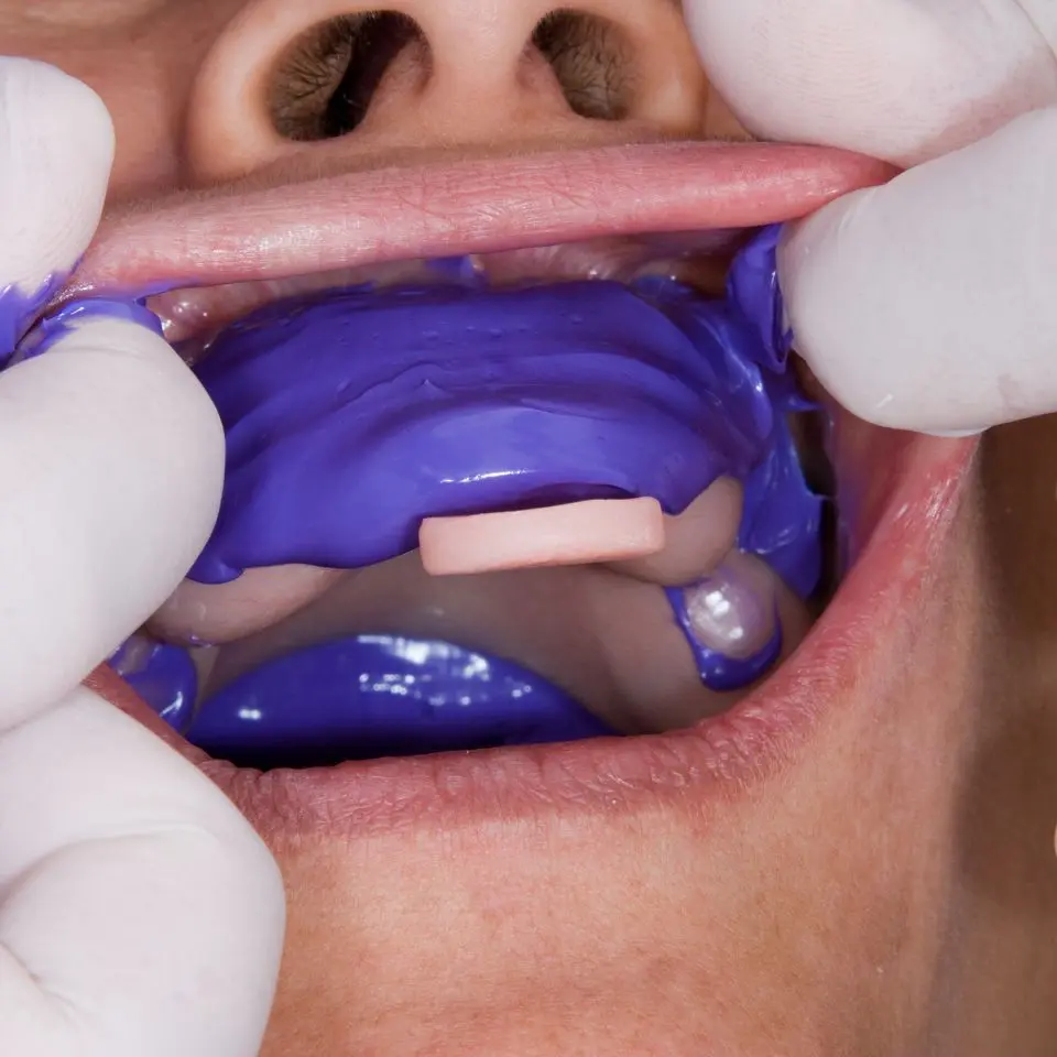 dental treatment