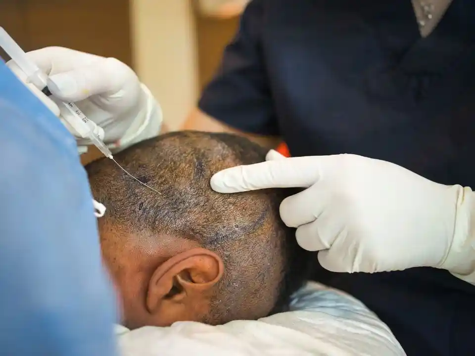 Hair transplantation service near me for better hair growth