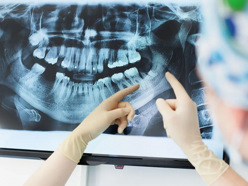 3-D Dental x-ray procedure at affordable cost