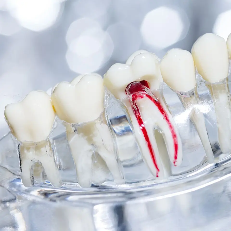 dental checkup in tirupati