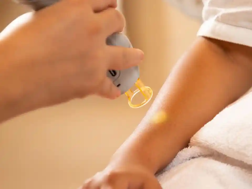 laser ski treatments for brighter skin near me