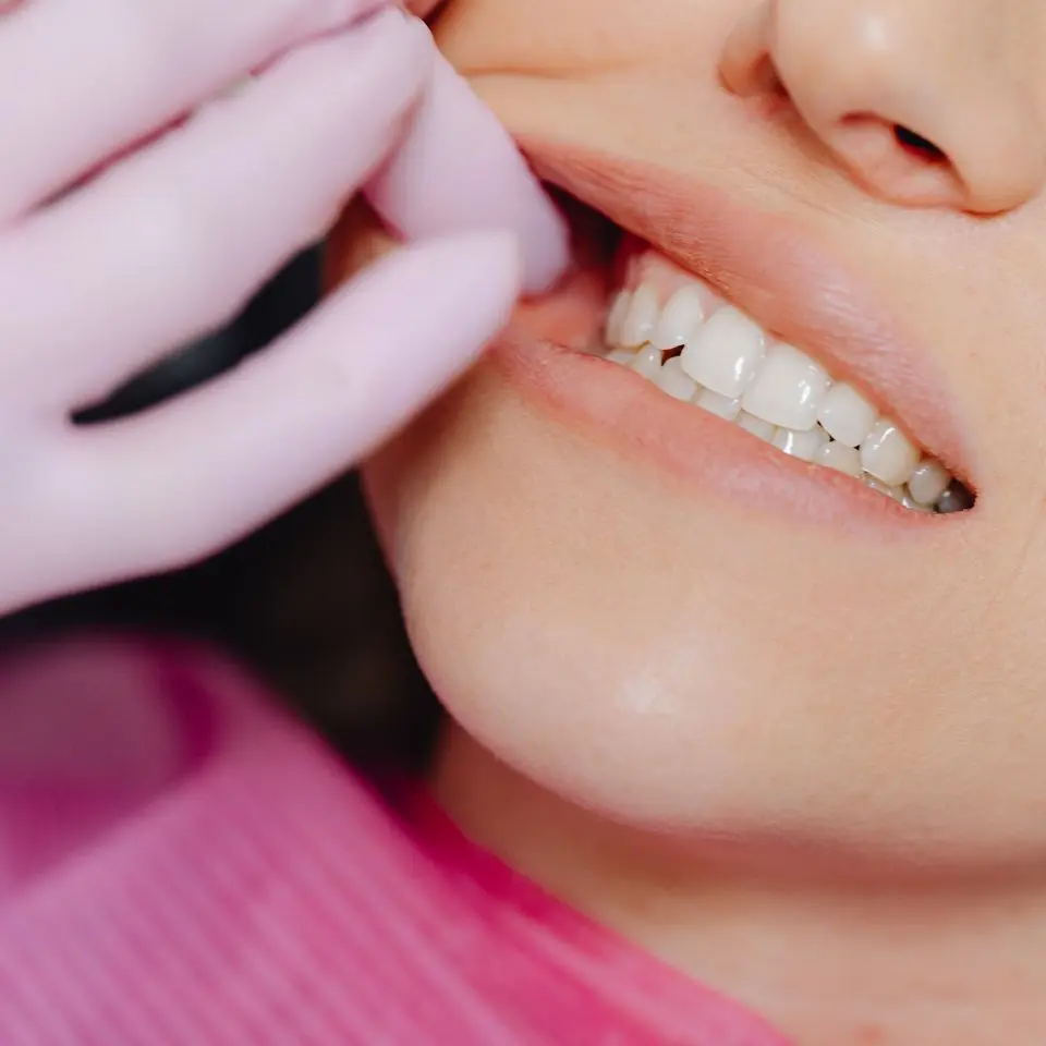 regular dental checkups in tirupati