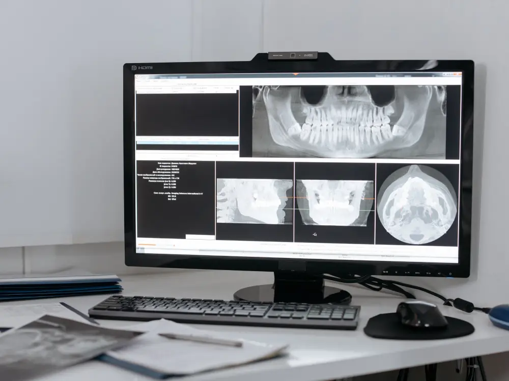 Digital dental treatments in tirupati