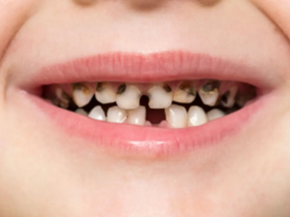 puppotomy treatment in tirupati