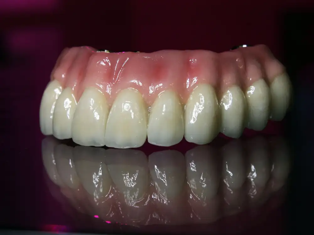 dental crown treatment in tirupati