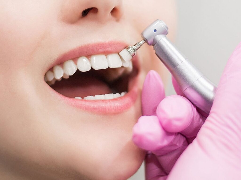 dental cleaning in tirupati